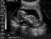 baby18wk.jpg (22635 bytes)