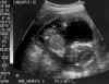 babyboy1.jpg (22538 bytes)