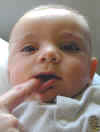 Teething